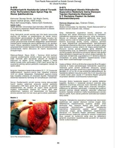 Lateral Spiral Flap